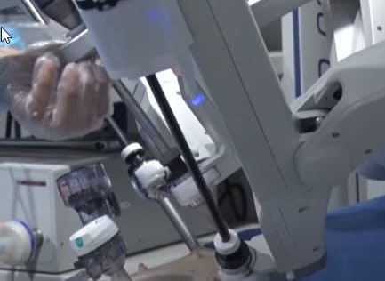 Operación de cirugía a 136 km de distancia en un hospital de China